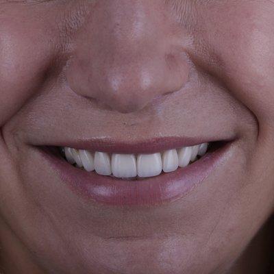 Cosmetic Dentistry