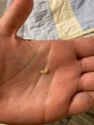 Piece of filling that fell out after flossing