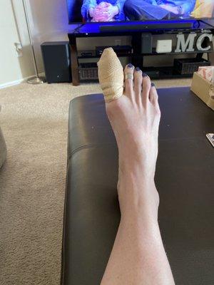 Bandaged toe on its way to a full recovery!