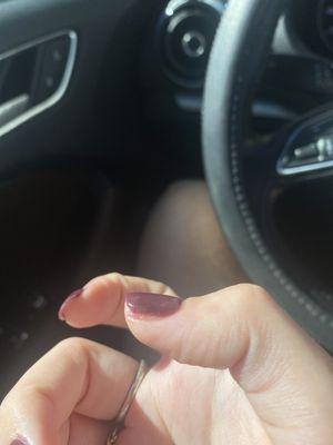 Filed off this complete side of my thumb.