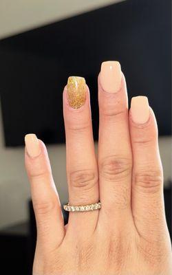 Crooked fingernail