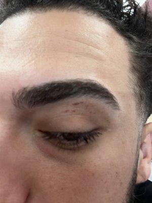 Cut and scabbed eyebrow.