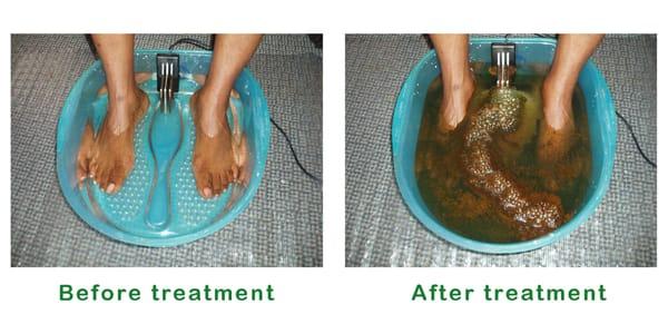 Detox Foot Bath