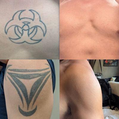 Before and after of my chest and shoulder tattoo.