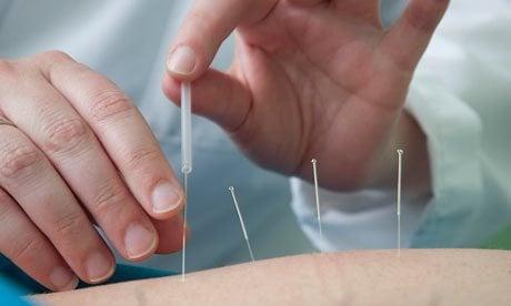 Holistic Acupuncture