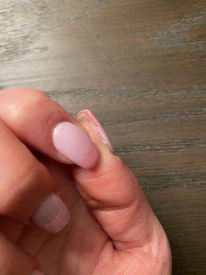 Skin separated from my nail from her file