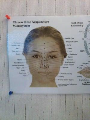 Acupuncture of the nose. Who knew!