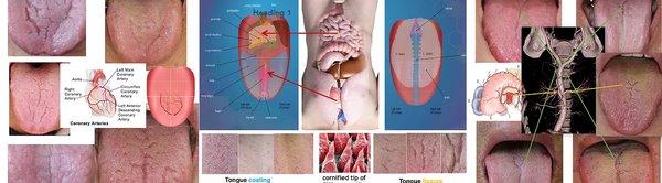 (Pattern Tongue Diagnosis) It reflects the condition of a specific organs in a certain area of the tongue