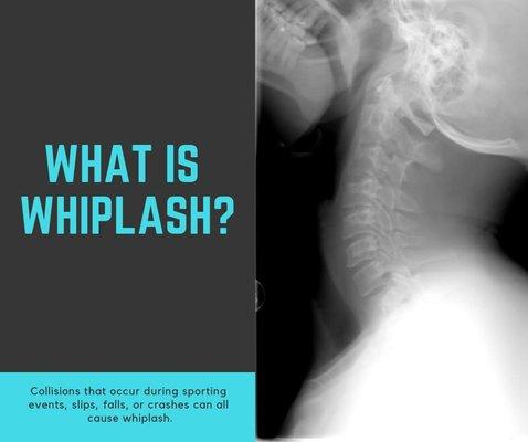 What is whiplash?  https://bit.ly/2FkOF8z