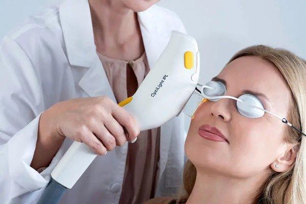 Intense Pulse Light Treatment