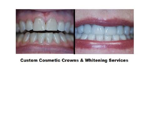 Custom Cosmetic Dentistry & Whitening Services.