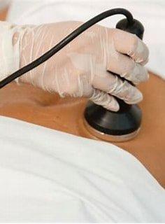 This non-invasive body shaping procedure Ultrasonic cavitation penetrates the skin and dissolves fat cells into liquid by using low-frequenc