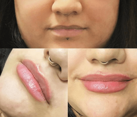 Lips by Tina, RN