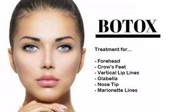 Monthly Botox Party