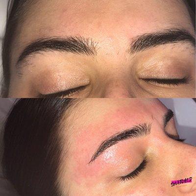 Brow reshaping