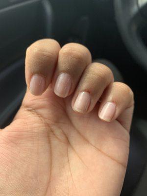 Cut cuticles, bleeding, uneven thin polish