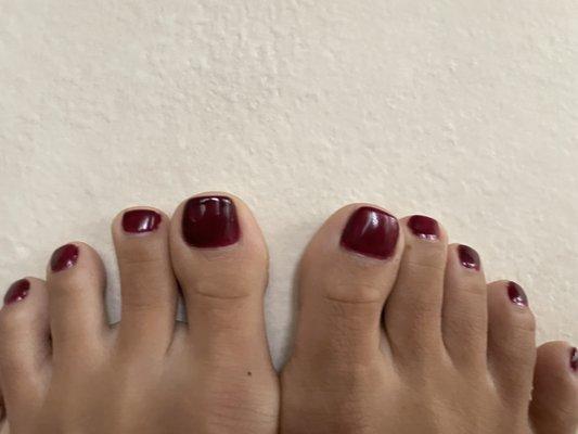 Right toes are darker than my left toes.