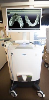 Our iTero scanner eliminates the need for messy study model and Invisalign impressions