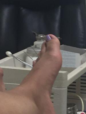 5 to 6 needles on each foot