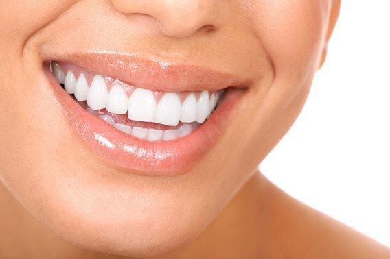 Let us brighten that beautiful smile of yours with professional teeth whitening service by one of our certified teeth whitening technicians.