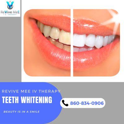 Teeth Whitening  
Bring your bright SMILE to all
Your Summer time FUN!!