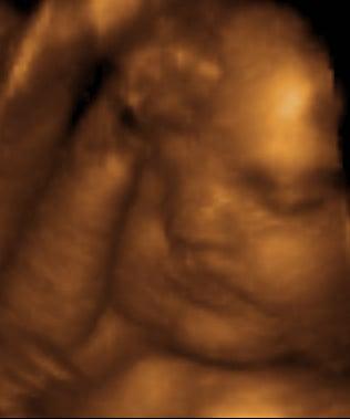 3d 4d ultrasound studio fort walton beach, destin, niceville, pensacola, crestview, florida