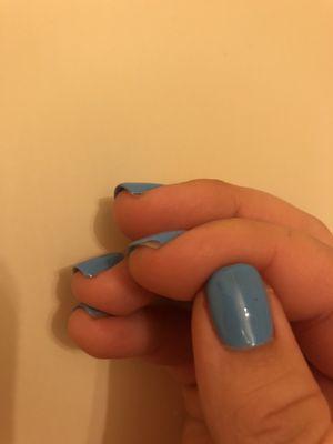 Nails peeling