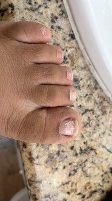 After effects of a cheap pedicure. This is just with regular nail polish. No gel nails.