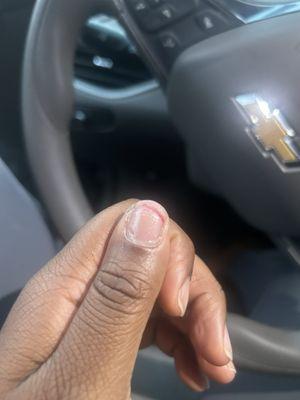 She completely tore off my nail. This place is horrible!