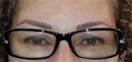 Newly done permanent eyebrows. Color will soften in about one week.