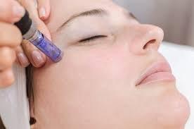 Microneedling & Cosmetic Acupuncture