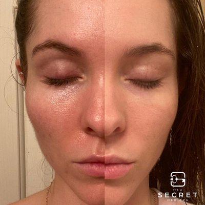 SkinBetter Even Tone Correcting Serum