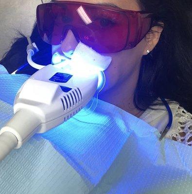 Teeth whitening.