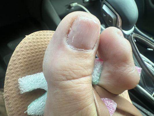 Fresh pedicure gone wrong!