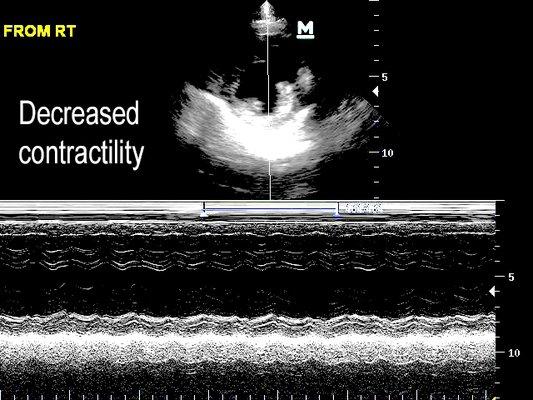 Lethargic dog, poor contractility means heart medications are necessary.