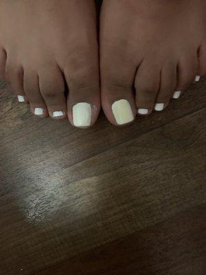 Yellow toes