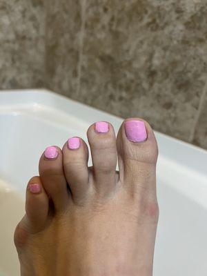 The worst pedicure