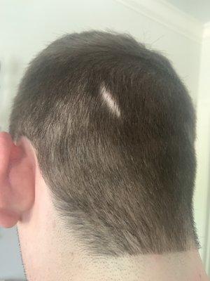 Shaved a hole in my hair