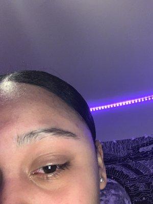 Bald spot on my eyebrows.