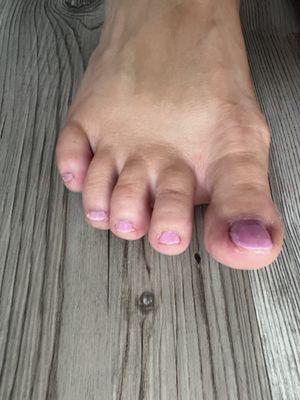 Horrible pedicure. Jagged edges, very sloppy polish.