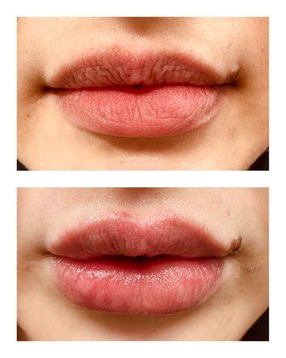 Plump up those lips! :)