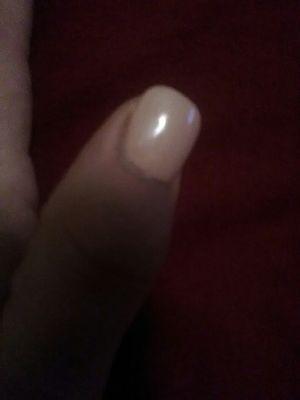 Huge gap around  the cuticle.