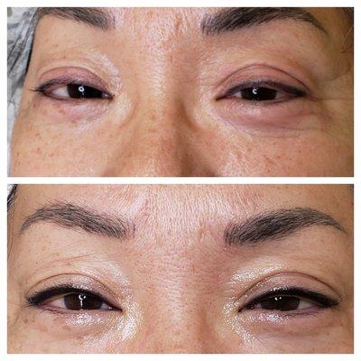 Permanent eyeliner (upper).