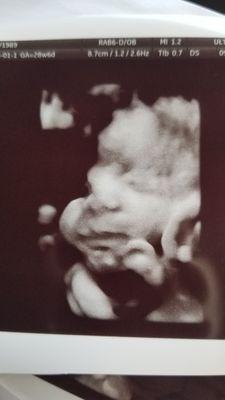 Sonogram of baby boy