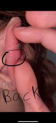 Swollen piercing