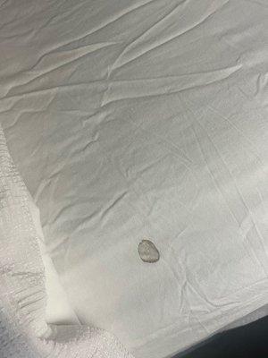 Stain on sheets upon arrival.