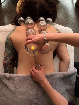 Cupping