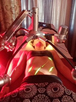 Treating mid-section - Tighten skin (boost elastin/collagen). Fat Loss inches resulting in improved BMI, Slimmer core.