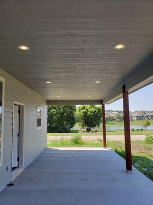 Outdoor lighting can take many forms, but recessed lighting is a sleek way to get tons of light!