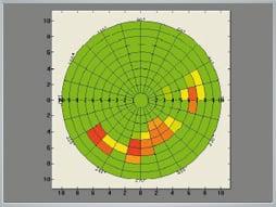 Picture of the Tear Film using the Oculus Keratograph.